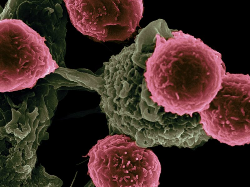 Méně než polovina nových léků proti rakovině měla výrazný přínos, uvádí studie